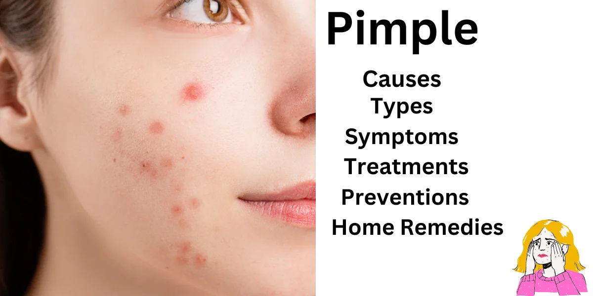 Pimple