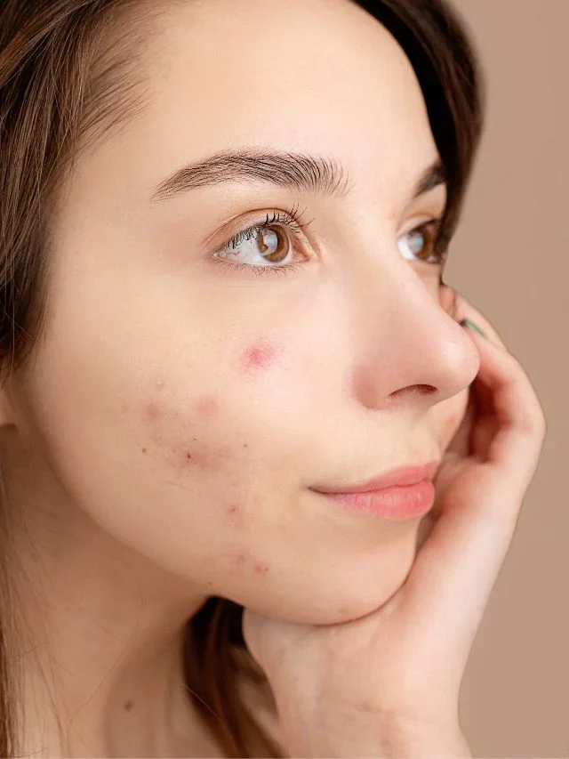“The Ultimate Guide to Treat Rash on Face:” Hidden Remedies”