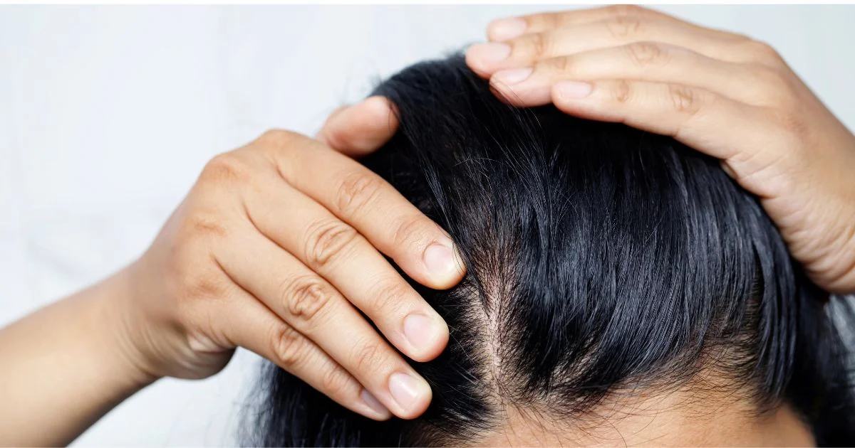 B12 Deficiency  and Itchy Scalp